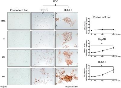 Anti-tumor Effect of Oleic Acid in Hepatocellular Carcinoma Cell Lines via Autophagy Reduction